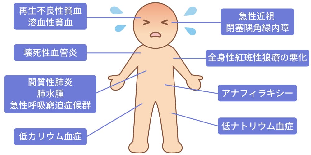 ヒドロクロロチアジドの副作用イメージ画像