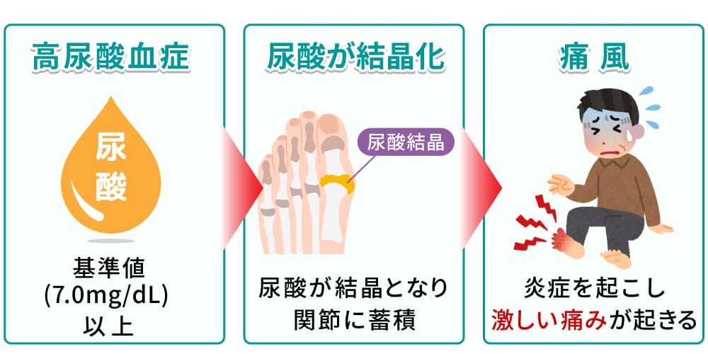 痛風とは?イメージ画像