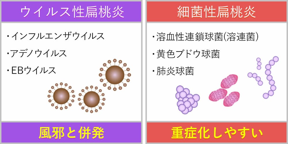 扁桃炎の原因画像