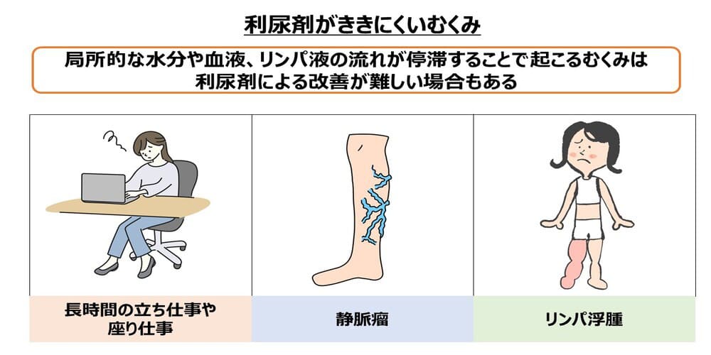 利尿剤が効きにくいむくみ画像