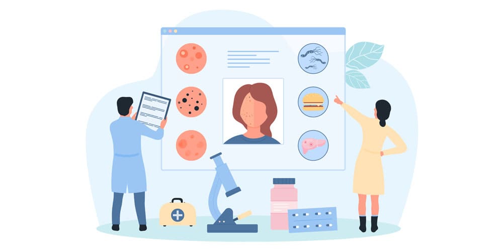 ニキビ再発の原因画像