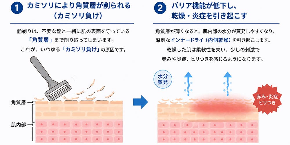 皮脂量とシェービングによる影響画像