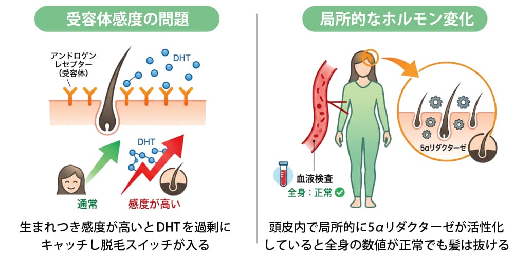 なぜホルモン値が正常でも薄毛になるのか
