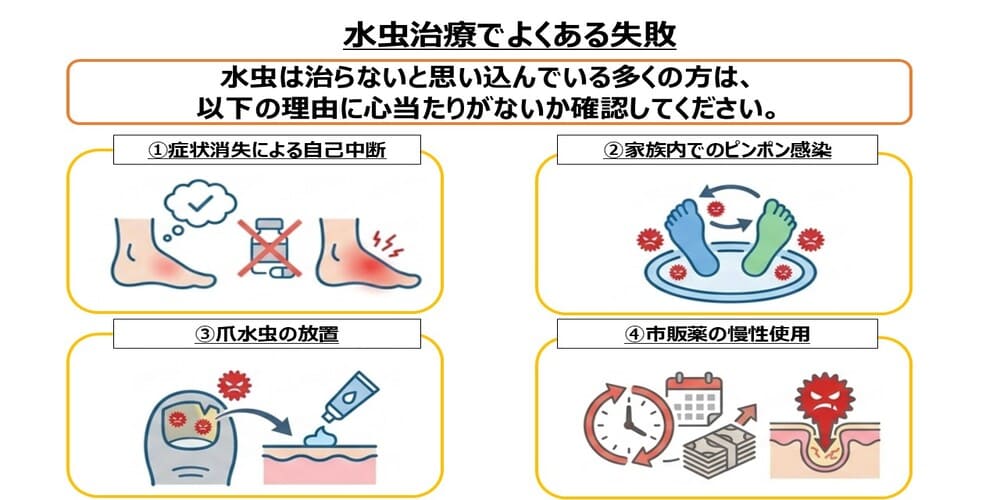 水虫治療でよくある失敗画像