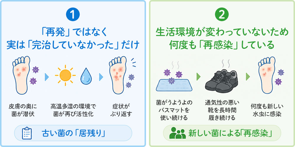 水虫はなぜ再発しやすいのか画像