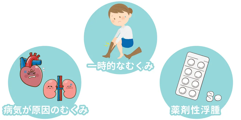 むくみの原因画像