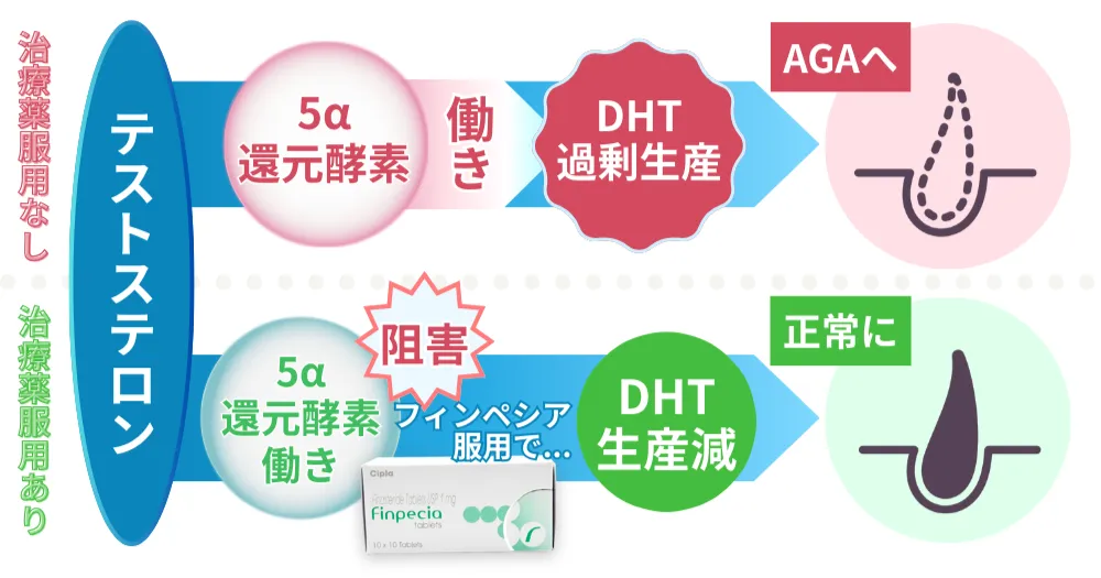 AGAになる流れとフィンペシアを服用した場合の比較画像