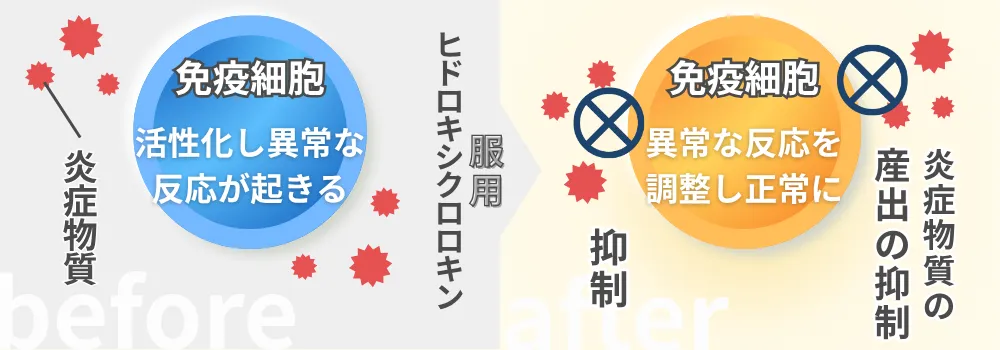 ヒドロキシクロロキンの簡単な作用図